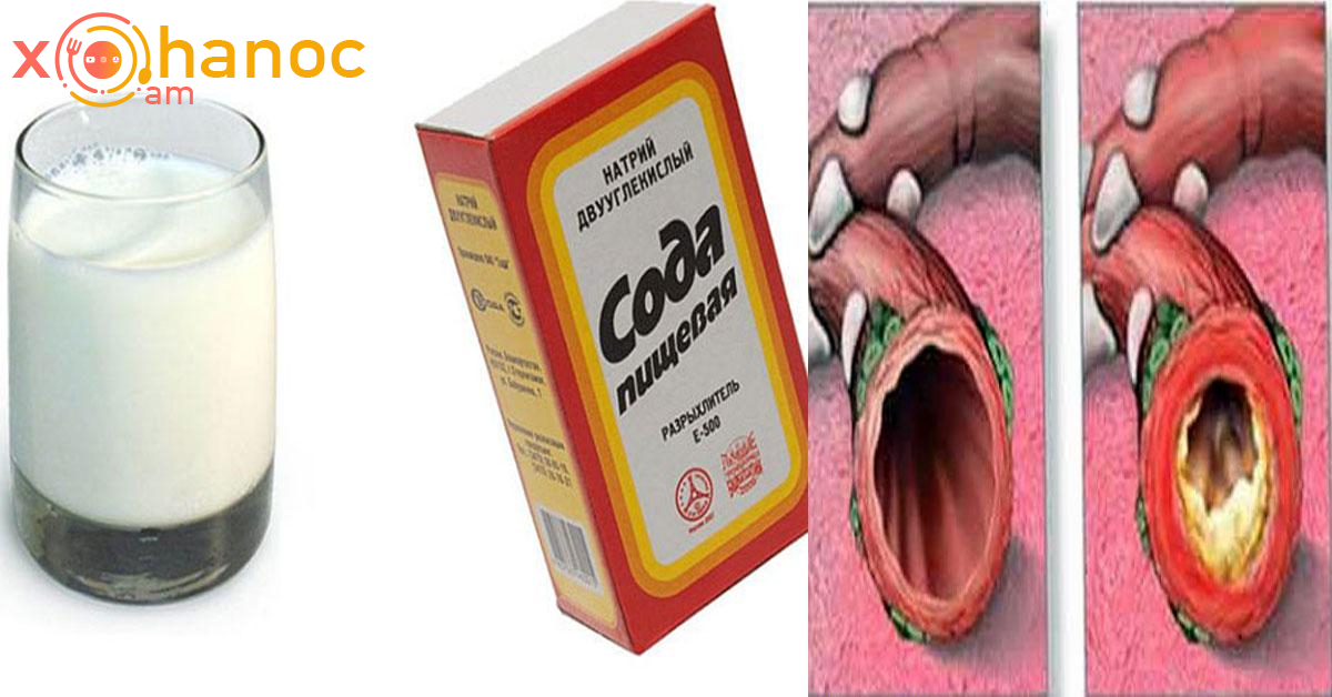 Հազիր և բրոնխիտից ազատվելու լավագույն միջոցներից մեկը սա է․ Խմիր քնելուց առաջ