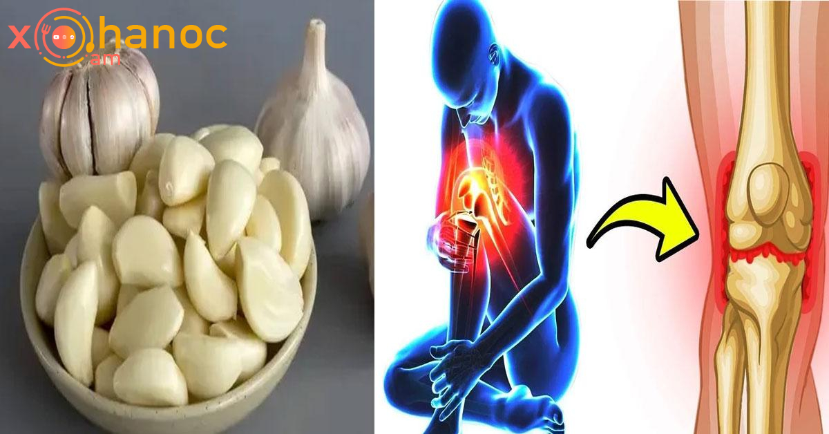 Սխտորը կվերականգնի հոդերի առողջությունն ու ոսկորների ցավը