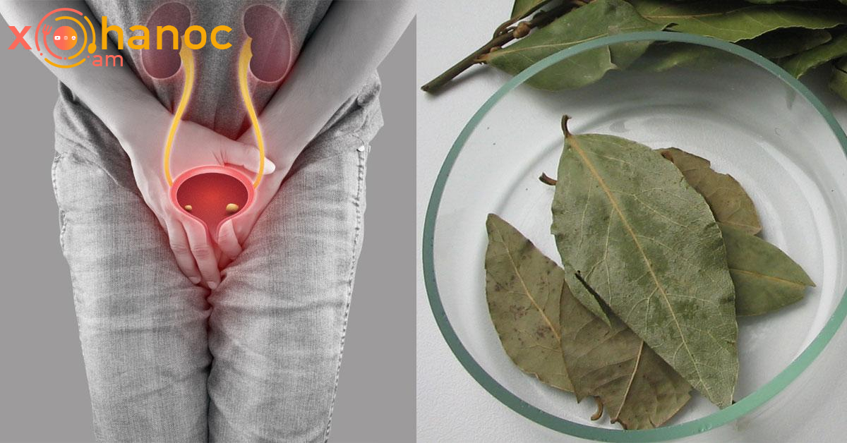 Ազատվել եմ ցիստիտ դափնու տերևի միջոցով․ Ահա գաղտնիքը