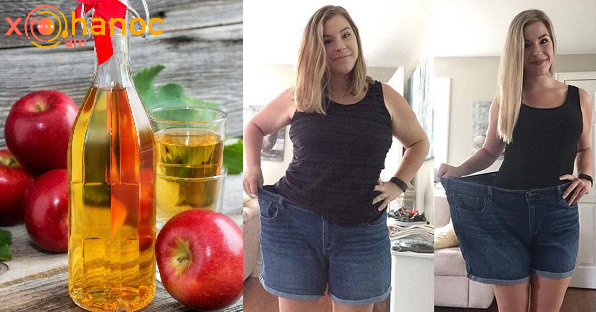 56 տարեկանում նիհարել եմ և փորիս մաշկը ձգվել է շնորհիվ այս բաղադրատոմսի. Բաղադրատոմսը թողնում եմ մեկնաբանության մեջ 56 տարեկանում նիհարել եմ և փորիս մաշկը ձգվել է շնորհիվ այս բաղադրատոմսի. Բաղադրատոմսը թողնում եմ մեկնաբանության մեջ