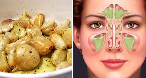 Հարբուխի և մրսածության դեմ հրաշք ապուր, որն ավելի հզոր է, քան դեղամիջոցները 