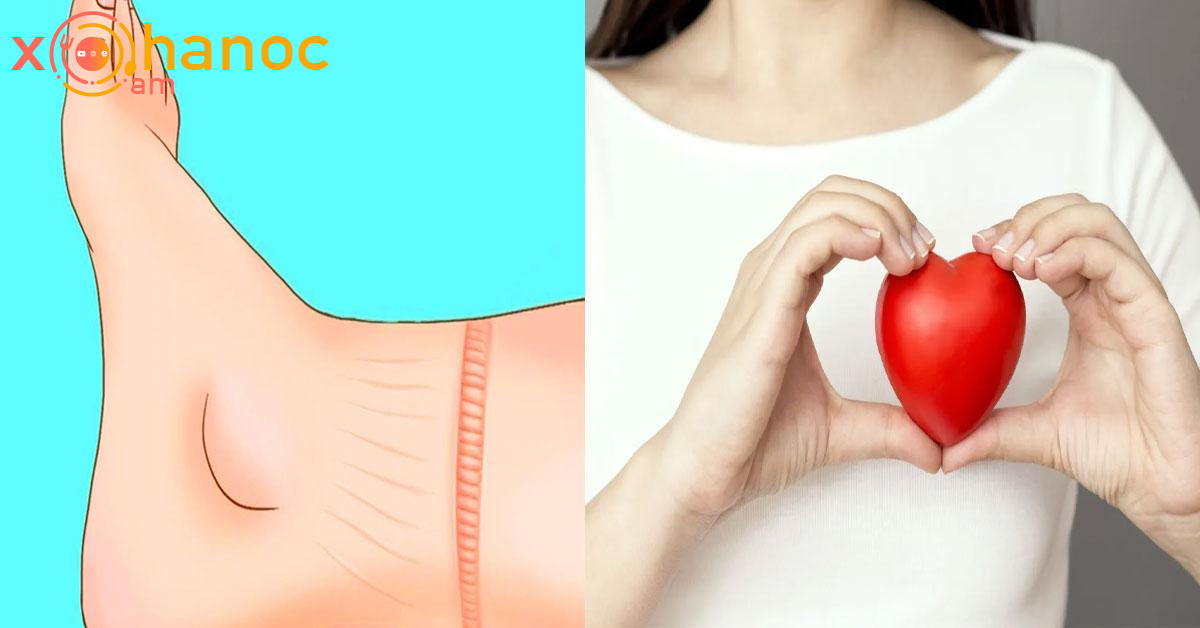 Նախազգուշացնող նշան, որ ձեր սիրտը լավ վիճակում չէ