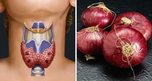 Նա սոխով թրջոց դրեց պարանոցին. 2 ժամ անց հրաշք կատարվեց 