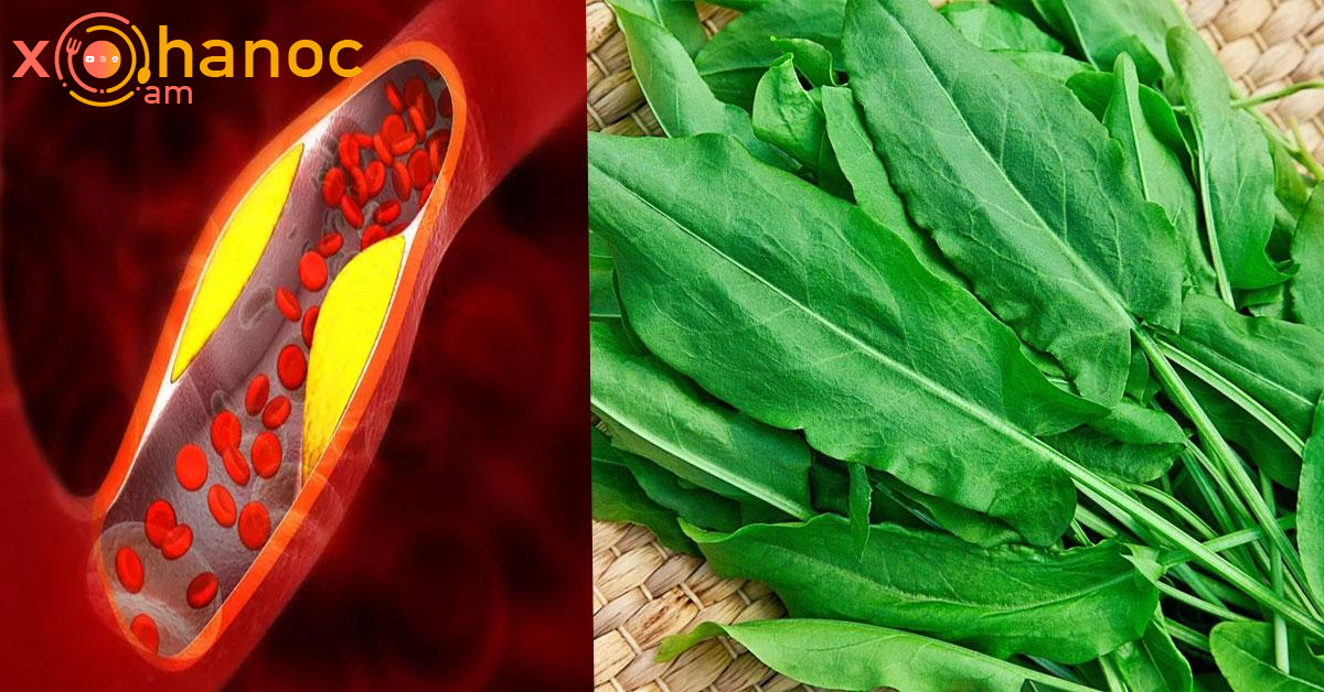 Այս կանաչին իջեցնում է բարձր ճնշումն ու խոլեստերինը․ Անպայման փորձեք