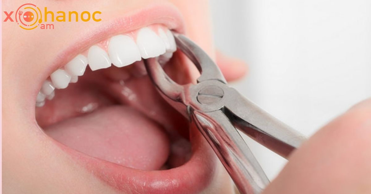 Ատամնաբույժը բացատրեց, որ մշտական այս խնդիրը կարող է հանգեցնել ատամների կորստի