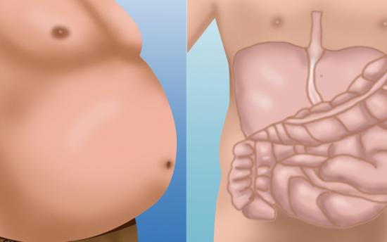 Դուք գեր չեք, ձեր ստամոքսն ուռած է. ինչպես ազատվել այս խնդրից
