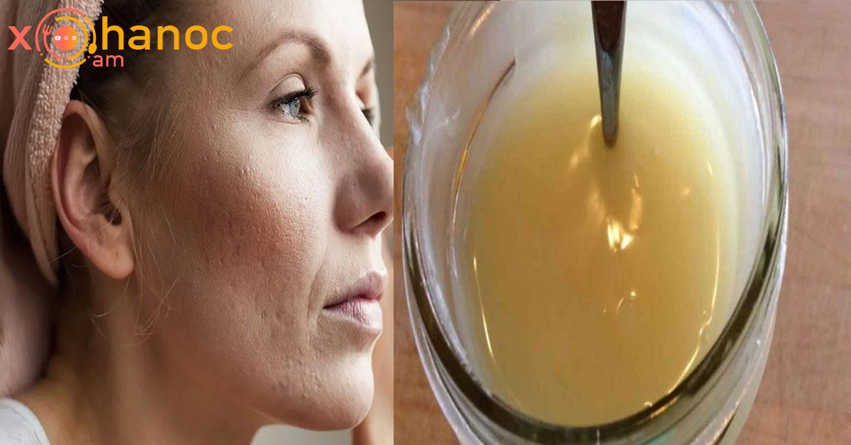 Սա բնական բաղադրատոմս է, որը կհարթեցնի ձեր մաշկը, կվերացնի պզուկները, ծակոտկիները և սպիերը