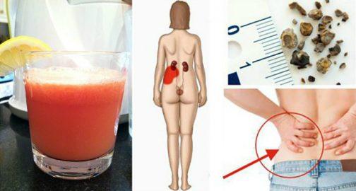 Ներկայացնում ենք բնական միջոցներից պատրաստված հյութ, որը մաքրում է լեղապարկի և երիամների քարերը