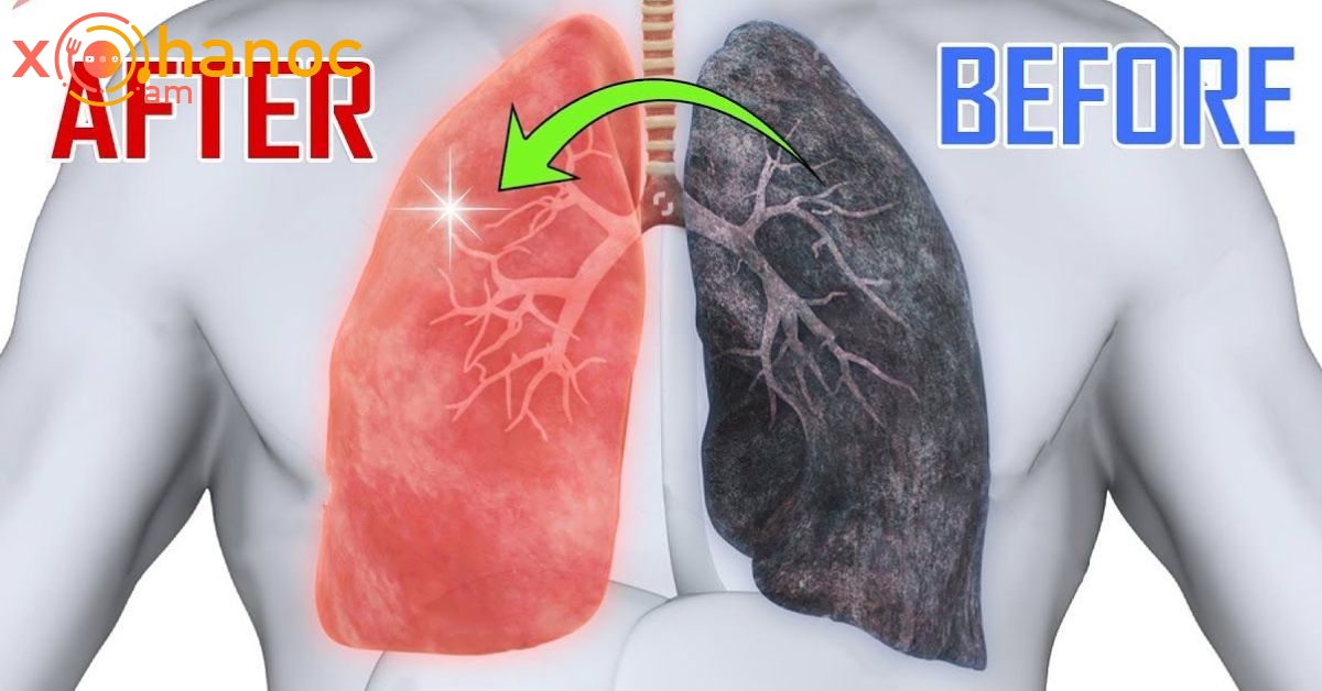 Ինչպես մաքրել թոքերը խորխի, ծխի և ծխախոտի խեժից․ բժիշկը 4 արդյունավետ միջոց է առաջարկել
