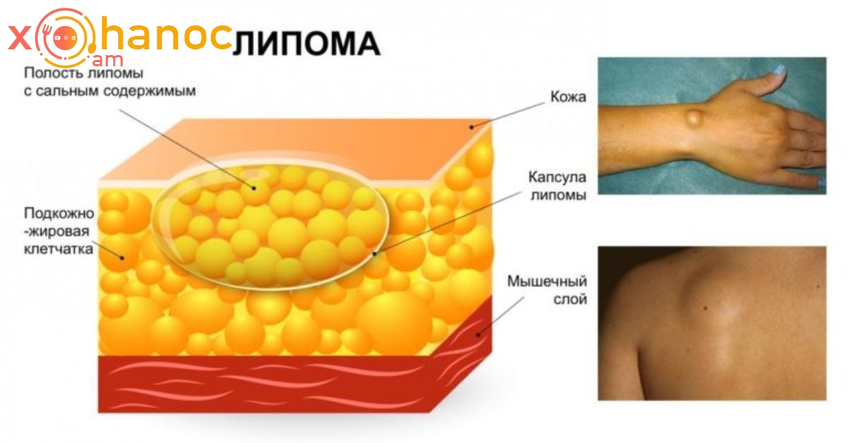 Состоит из фиброзной и жировой капсулы