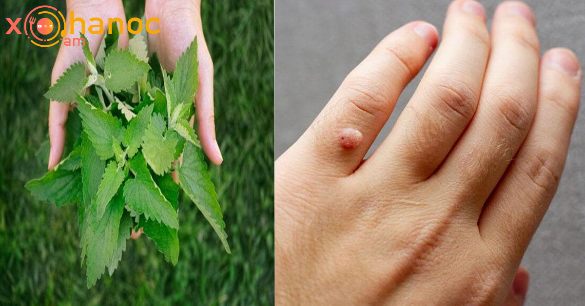 Գորտնուկները վերացրեք այս բույսով