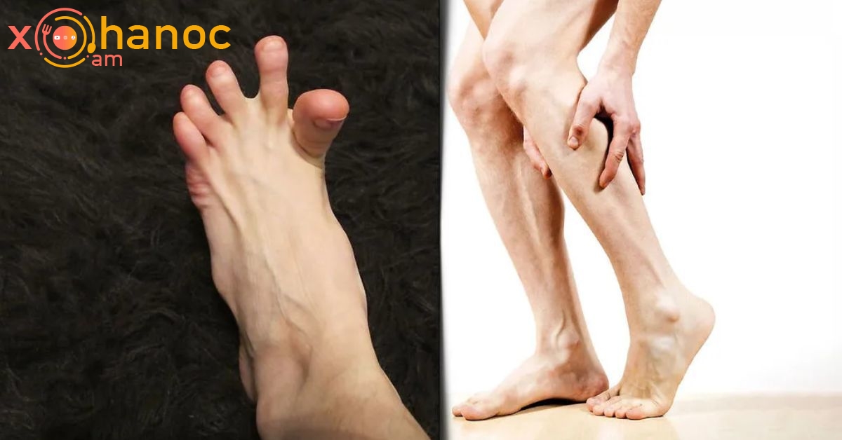 Сводит ноги судорогой лечение у мужчин. Напряженные ноги.