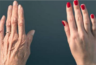 Վերադարձրեք ձեռքերի բնական գեղեցկությունը