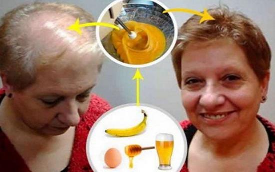 Վերադարձրեք կորցրած մազերը