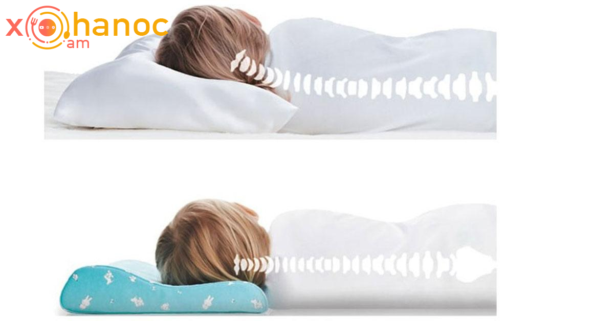 Բարձով քնելն է ճիշտ, թե առանց բարձի․ Բժշկի պատասխանը