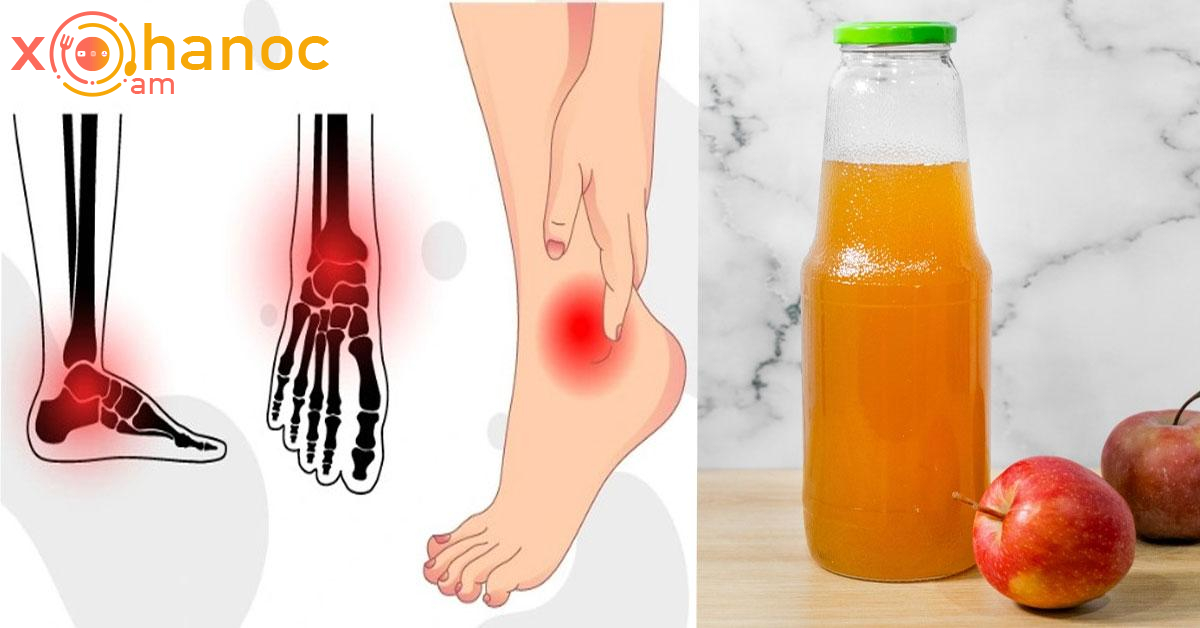 Ազատվեք ոտքերի ցավից․ Կօգնի ձեզ այս միջոցը