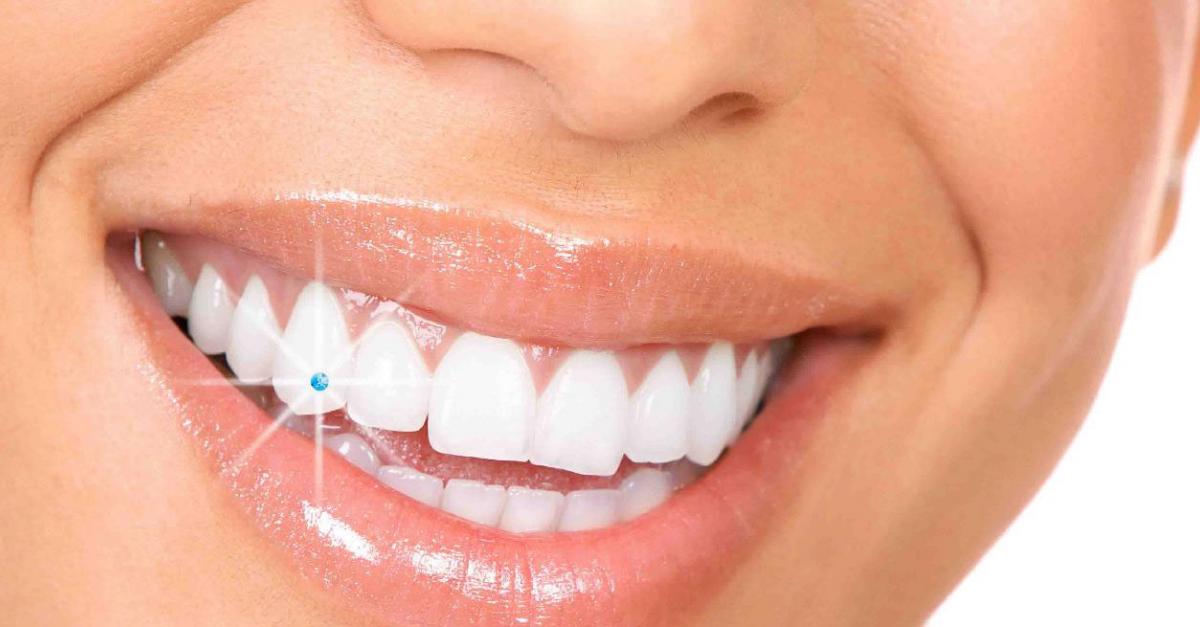 Ինչպե՞ս վերացնել ատամի ցավը, ճերմակեցնել ատամները և  այլ հիանալի խորհուրդներ կապված ատամների հետ