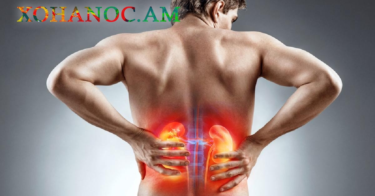 8 ամենօրյա սովորություն, որոնք լուրջ վնաս են հասցնում երիկամներին: Գրում է 168.am-ը