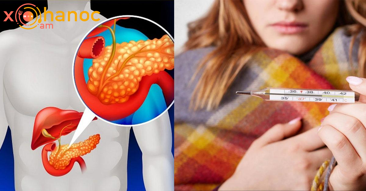 Այս նշան է, որը վկայում է, որ ձեր ենթաստամոքսային գեղձը հիվանդ է