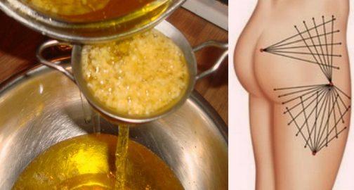 Ինչպես վերականգնել կազմվածքը 40-ից հետո. Պարզապես այս մթերքն ավելացրու սննդակարգումդ