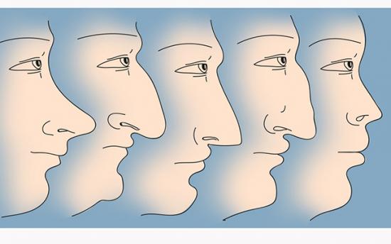 Ինչ կարող է պատմել մարդու մասին քթի ձևը