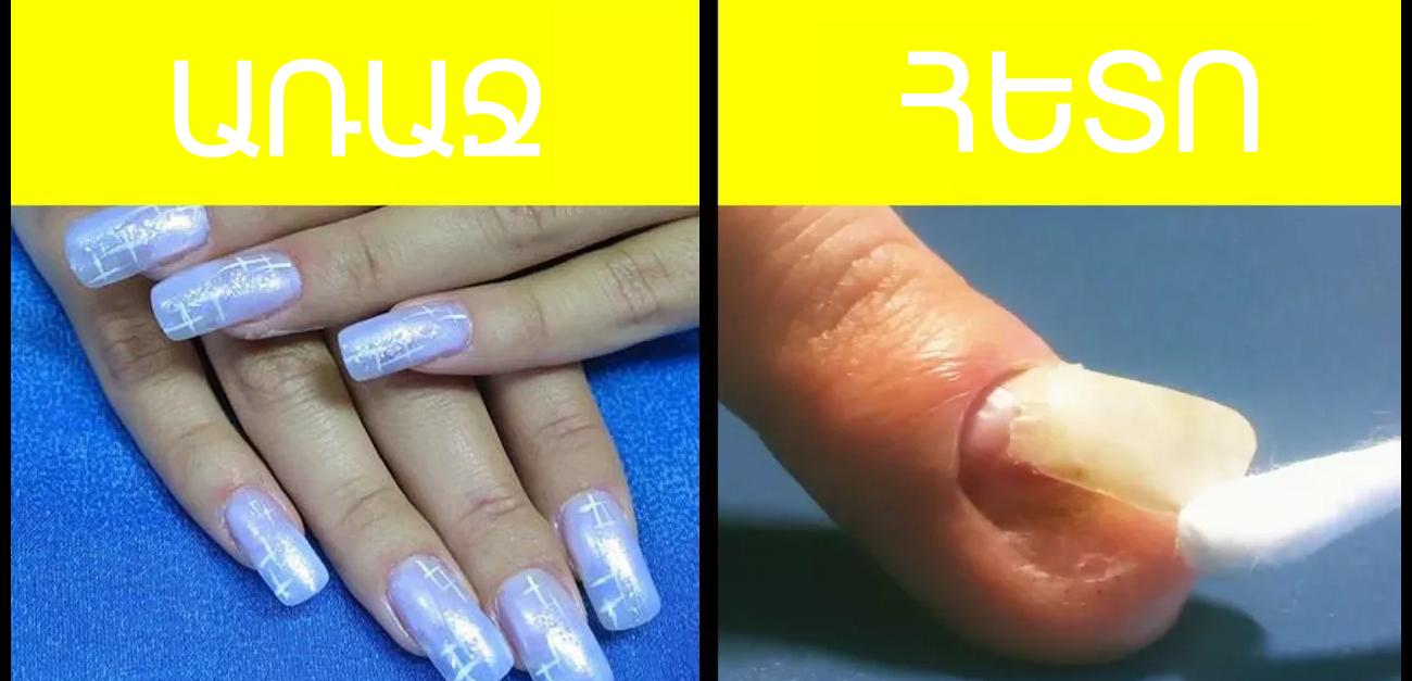 Ձեր եղունգներին գել-լա՞ք եք անում․ Տեսեք, թե ինչ կարող է դրա հետևանքով պատահել դրանց հետ