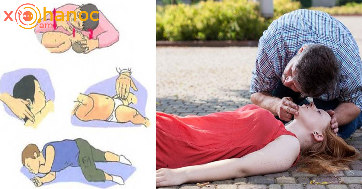 Սրտի կանգի ժամանակ շատ արագ այսպես արեք հիվանդին, որպեսզի չմահանա և փրկեք նրա կյանքը