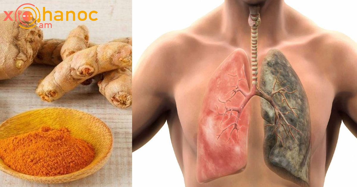 Թոքերը մաքրելու ամենաարդյունավետ միջոցը սա է․ Առաջին օրը արդեն իսկ կզգաք փոփոխությունը