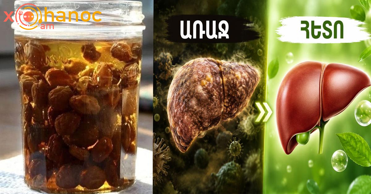 Ընդամենը 2 բաժակ և 3 օր․ Ձեր լյարդը ամբողջությամբ կմաքրվի, կազատվեք 3 կգ թույնից