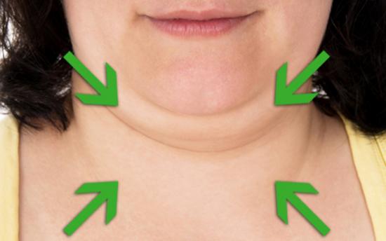 Ինչպես ազատվել երկրորդ կզակից և մաշկին առաձգականություն հաղորդել