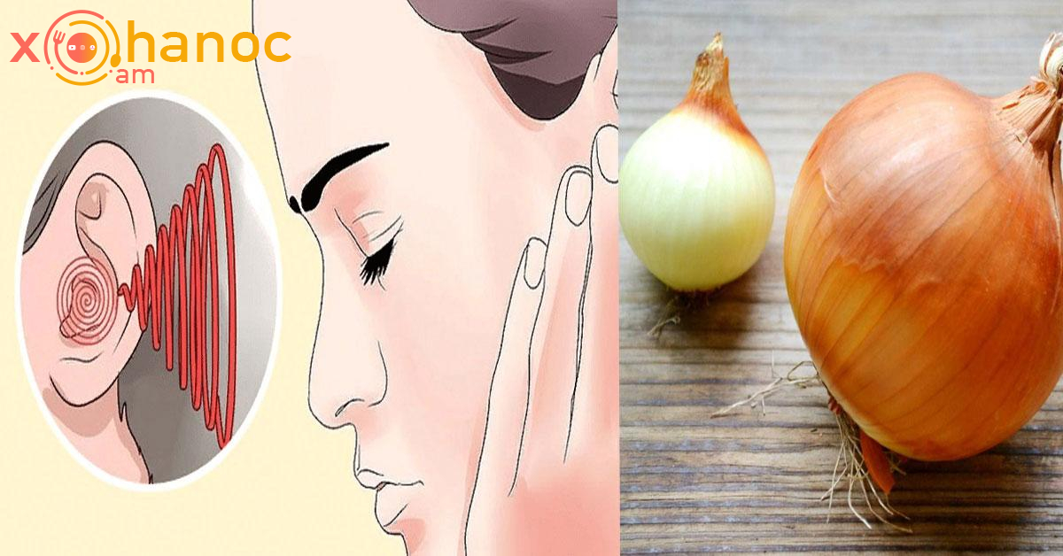 Եթե ունեք ականջների զրնգոց, սոխը կօգնի ազատվել այդ խնդրից Եթե ունեք ականջների զրնգոց, սոխը կօգնի ազատվել այդ խնդրից