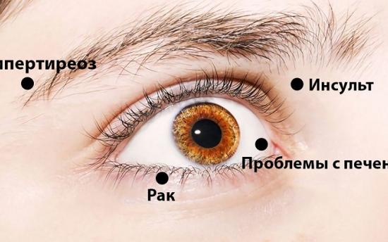 8 ազդանշան, որոնց միջոցով աչքերը զգուշացնում են առողջական խնդիրների մասին