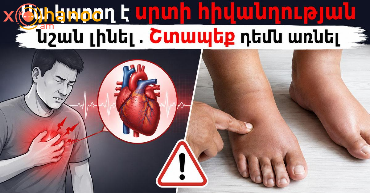Սա կարող է սրտի հիվանդության նշան լինել․ Շտապեք դեմն առնել