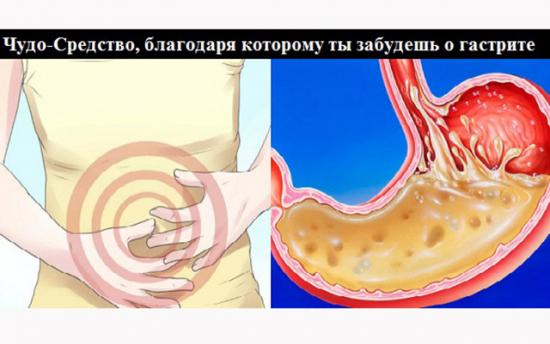 Բուժեք գաստրիտը. հրաշք բաղադրատոմս