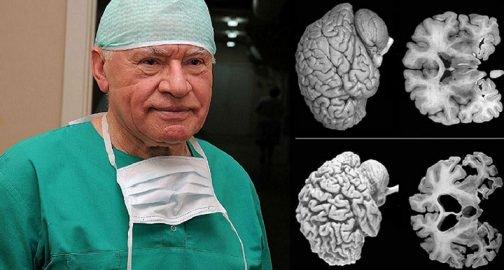 Բժիշկները զգուշացնում են. բոլոր կանայք պետք է ուշադիր լինեն ՍՐԱ հանդեպ 