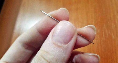 Ինչպե՞ս կարող է սովորական ասեղն ինսուլտի ժամանակ փրկել մարդու կյանքը