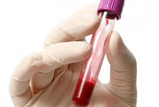 Արյան խումբն ավելին կարող է պատմել, քան պատկերացնում եք