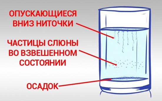 Կանդիդոզի ախտորոշում տնային պայմաններում՝ 90% ճշտությամբ 