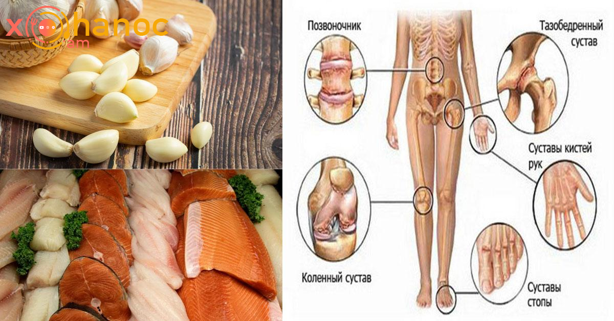 Մթերքներ, որոնք օգտակար են կոտրվածքների և հոդերի ցավի ժամանակ․ Պահպանեք այս ցանկը