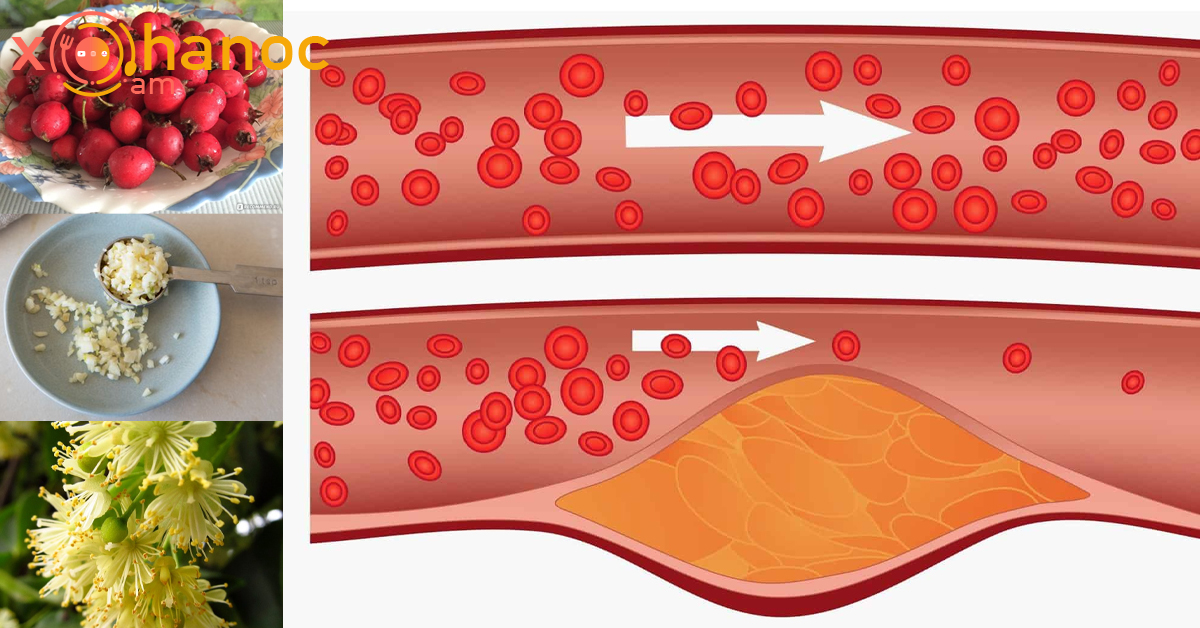 Այս մթերքները կմաքրեն ձեր անոթները և կլավացնեն արյան շրջանառությունը