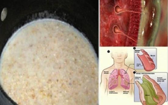 Ըմպելիք, որը կլավացնի իմունիտետն ու դուրս կբերի լորձը թոքերից