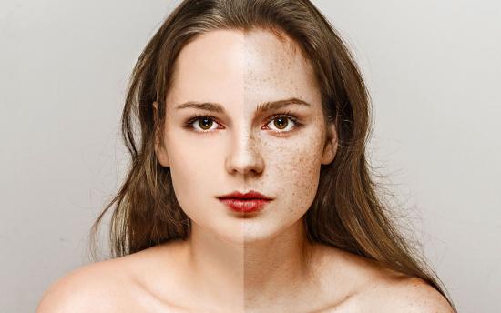 Ինչպե՞ս վերացնել պեպենները