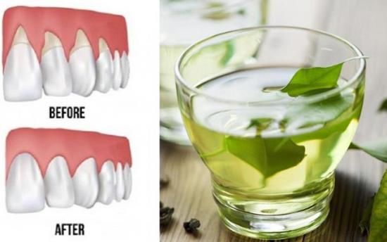 Բնական միջոցներ՝ լնդերի իջեցման դեմ