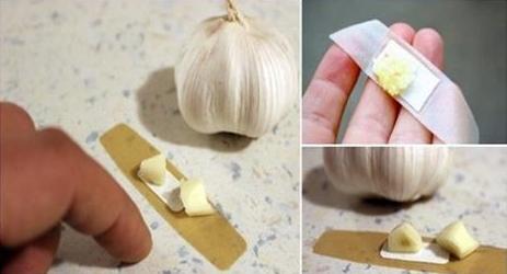 Ահա թե ինչ կպատահի, եթե ձեր մաշկին դնեք սխտորի մի կտոր