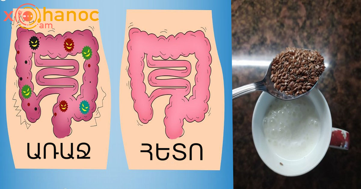 Այսպես մաքրեք ամբողջ աղիները ՝ հատկապես հաստ աղիքը և եղեք առողջ