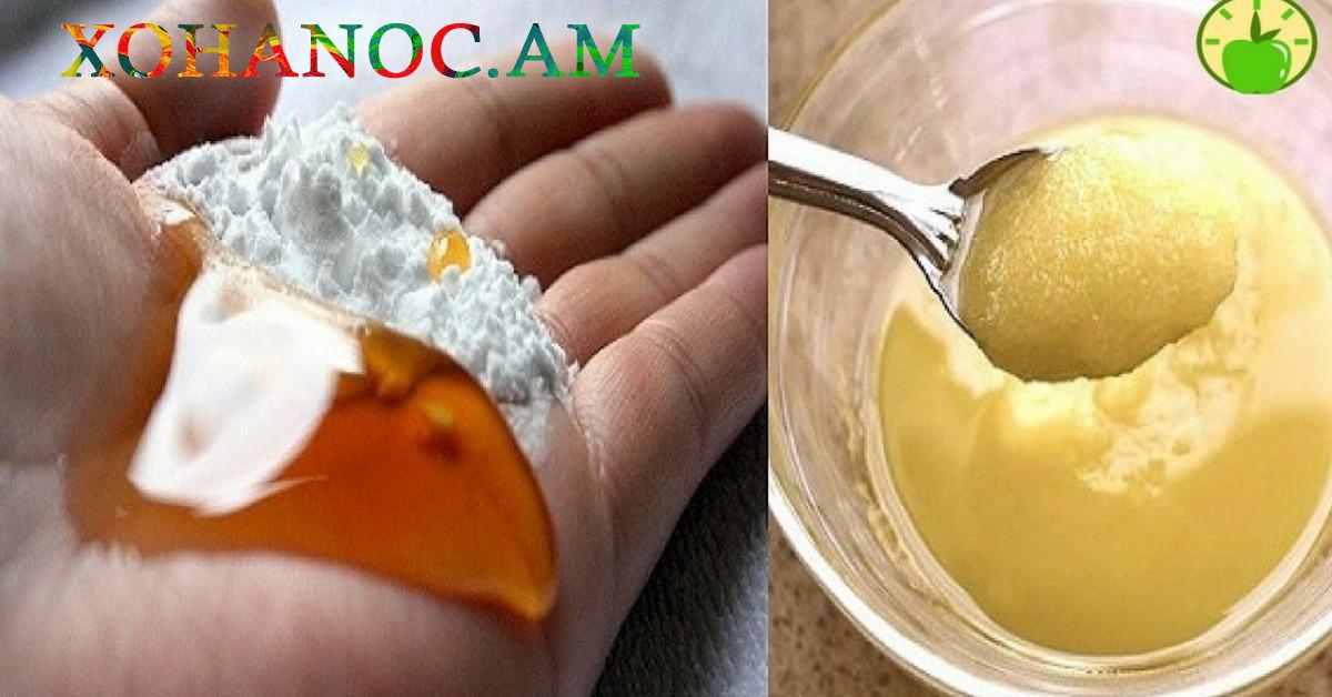 Սոդա և մեղր. Այս համադրությունը կբուժի քաղցկեղը և կվերացնի ինֆեկցիաները