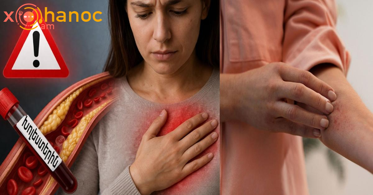 3 կարևոր նշան, որ ձեր խոլեստերինը բարձր է