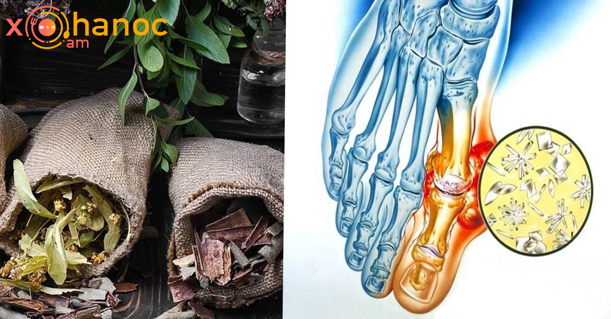 Սա դեղաբույսերից տնական դեղամիջոց է ՝ հոդերի ցավի, հոդատապի դեմ․ Այն մի քանի օրում ոտքի կկանգնեցնի ձեզ