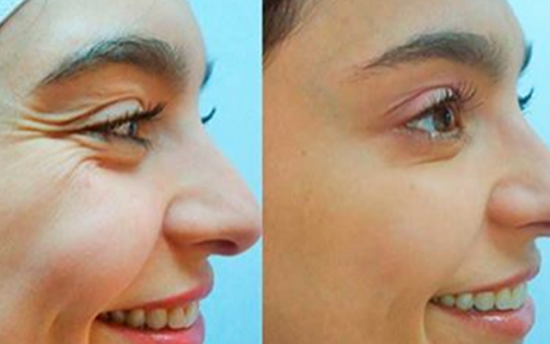 Լսե՞լ եք երիտասարդացնող էլիքսիրի մասին