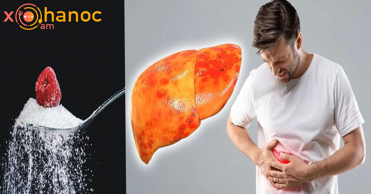 Մթերքներ, որոնք վնասում են լյարդը․ Այս ցանկը ամենավնասակար մթերքներն են լյարդի համար